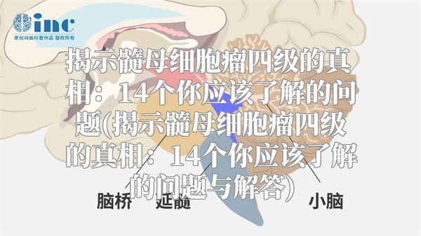 揭示髓母细胞瘤四级的真相：14个你应该了解的问题(揭示髓母细胞瘤四级的真相：14个你应该了解的问题与解答)