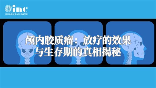 颅内胶质瘤：放疗的效果与生存期的真相揭秘