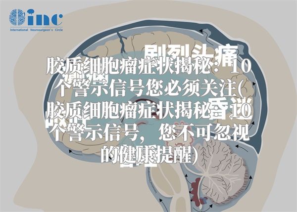 胶质细胞瘤症状揭秘：10个警示信号您必须关注(胶质细胞瘤症状揭秘：10个警示信号，您不可忽视的健康提醒)