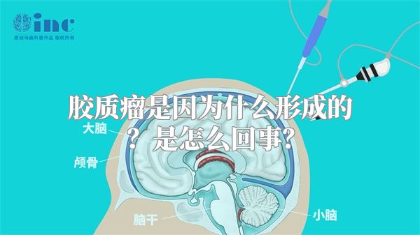 胶质瘤是因为什么形成的？是怎么回事？