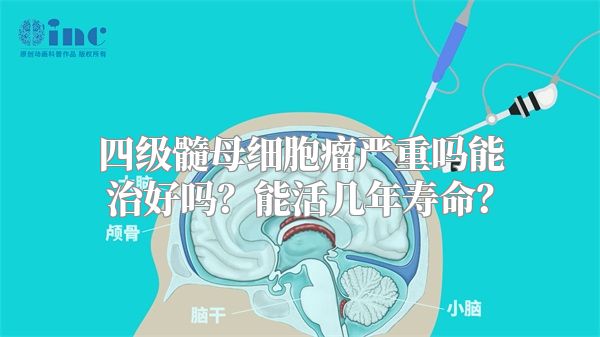 四级髓母细胞瘤严重吗能治好吗？能活几年寿命？