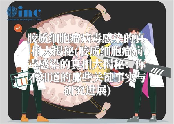 胶质细胞瘤病毒感染的真相大揭秘(胶质细胞瘤病毒感染的真相大揭秘：你不知道的那些关键事实与研究进展)