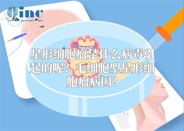 星形细胞瘤是什么病毒引起的呢？毛细胞型星形细胞瘤病因？