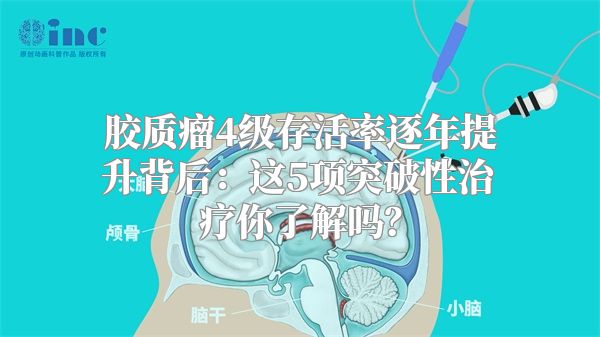 胶质瘤4级存活率逐年提升背后：这5项突破性治疗你了解吗？