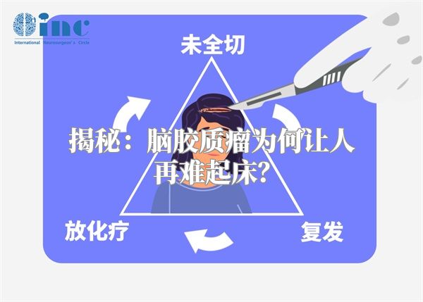 揭秘：脑胶质瘤为何让人再难起床？