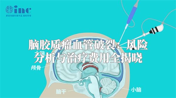 脑胶质瘤血管破裂：风险分析与治疗费用全揭晓