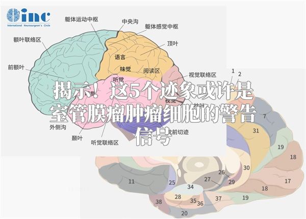 揭示！这5个迹象或许是室管膜瘤肿瘤细胞的警告信号