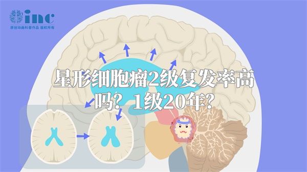 星形细胞瘤2级复发率高吗？1级20年？