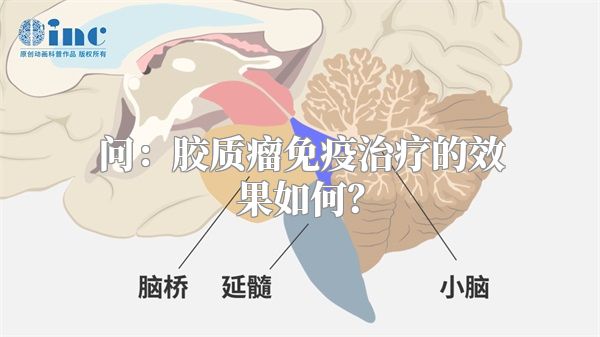 问：胶质瘤免疫治疗的效果如何？