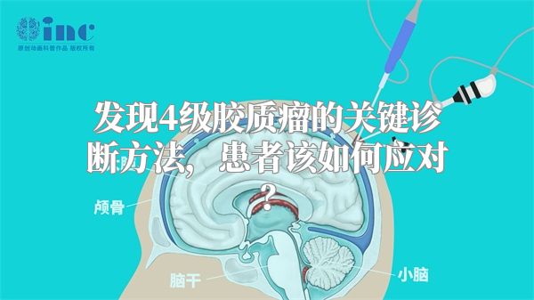 发现4级胶质瘤的关键诊断方法，患者该如何应对？