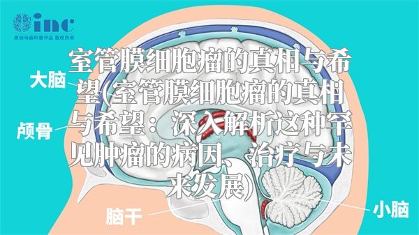 室管膜细胞瘤的真相与希望(室管膜细胞瘤的真相与希望：深入解析这种罕见肿瘤的病因、治疗与未来发展)