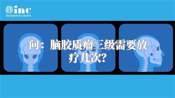 问：脑胶质瘤三级需要放疗几次？