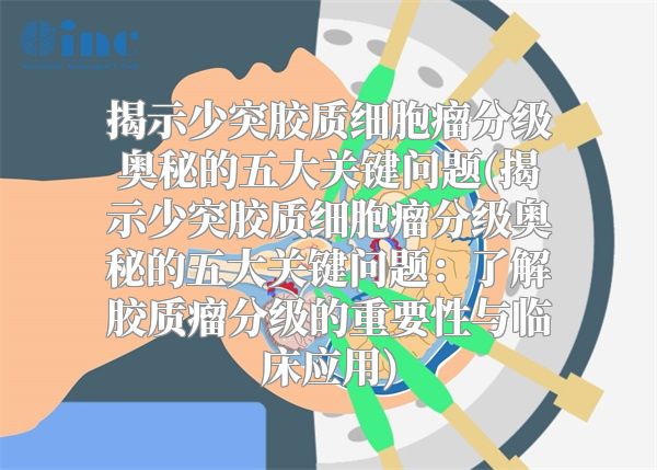 揭示少突胶质细胞瘤分级奥秘的五大关键问题(揭示少突胶质细胞瘤分级奥秘的五大关键问题：了解胶质瘤分级的重要性与临床应用)