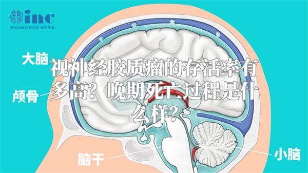 视神经胶质瘤的存活率有多高？晚期死亡过程是什么样？