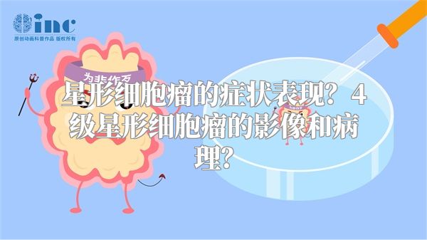 星形细胞瘤的症状表现？4级星形细胞瘤的影像和病理？