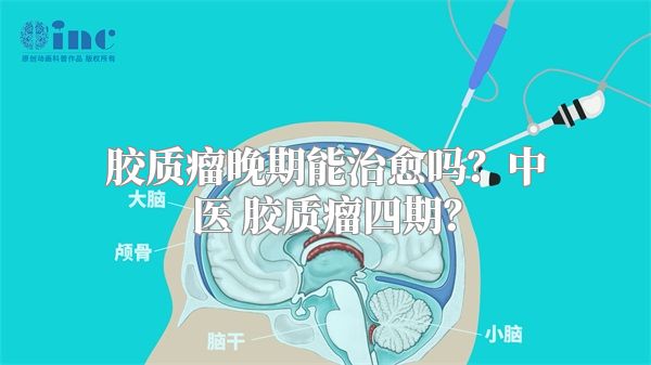 胶质瘤晚期能治愈吗？中医 胶质瘤四期？