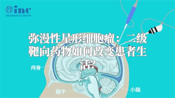 弥漫性星形细胞瘤：二级靶向药物如何改变患者生活？