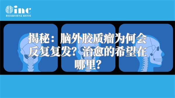 揭秘：脑外胶质瘤为何会反复复发？治愈的希望在哪里？