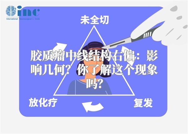 胶质瘤中线结构右偏：影响几何？你了解这个现象吗？