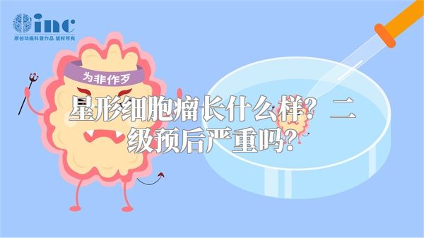 星形细胞瘤长什么样？二级预后严重吗？