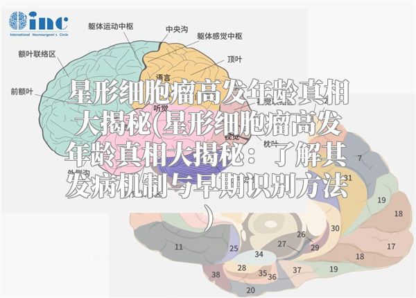 星形细胞瘤高发年龄真相大揭秘(星形细胞瘤高发年龄真相大揭秘：了解其发病机制与早期识别方法)