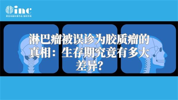 淋巴瘤被误诊为胶质瘤的真相：生存期究竟有多大差异？