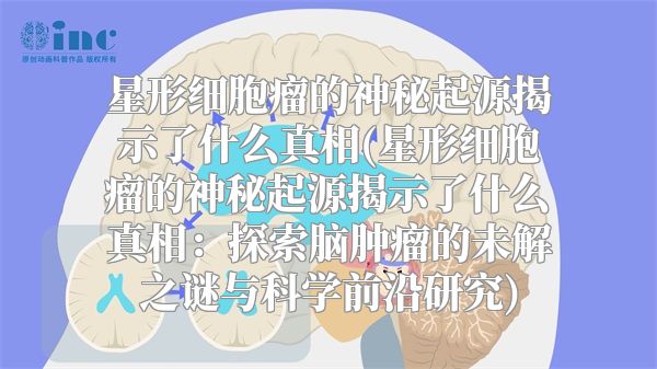 星形细胞瘤的神秘起源揭示了什么真相(星形细胞瘤的神秘起源揭示了什么真相：探索脑肿瘤的未解之谜与科学前沿研究)