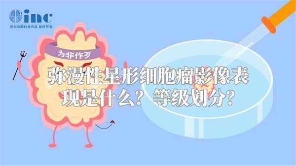 弥漫性星形细胞瘤影像表现是什么？等级划分？