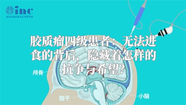 胶质瘤四级患者：无法进食的背后，隐藏着怎样的抗争与希望？