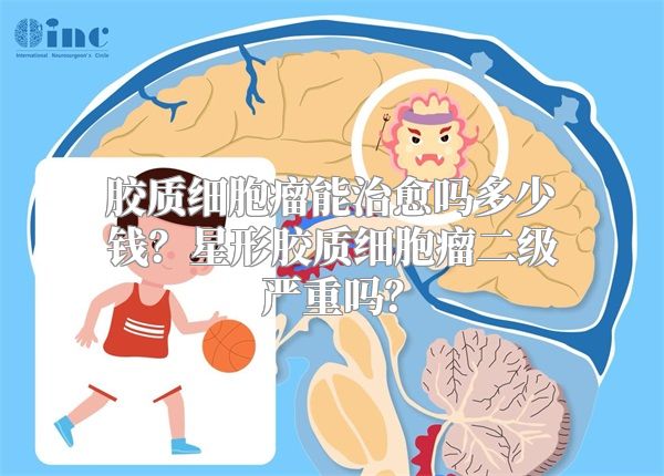 胶质细胞瘤能治愈吗多少钱？星形胶质细胞瘤二级严重吗？