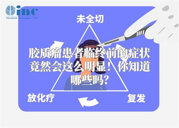 胶质瘤患者临终前的症状竟然会这么明显！你知道哪些吗？