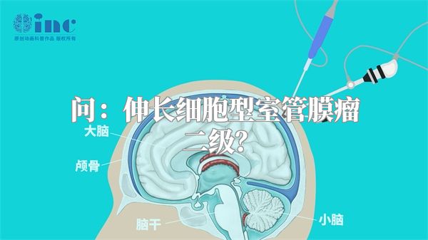 问：伸长细胞型室管膜瘤二级？