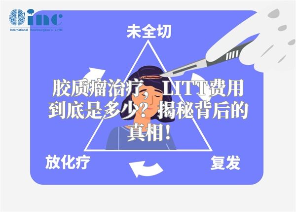 胶质瘤治疗，LITT费用到底是多少？揭秘背后的真相！