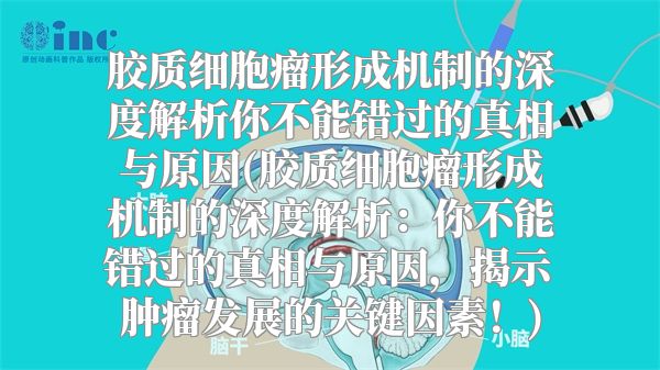 胶质细胞瘤形成机制的深度解析你不能错过的真相与原因(胶质细胞瘤形成机制的深度解析：你不能错过的真相与原因，揭示肿瘤发展的关键因素！)