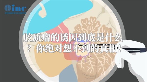 胶质瘤的诱因到底是什么？你绝对想不到的真相！