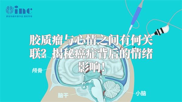 胶质瘤与心情之间有何关联？揭秘癌症背后的情绪影响！