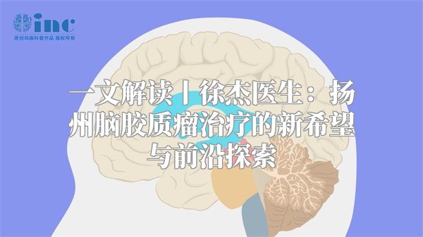 一文解读丨徐杰医生：扬州脑胶质瘤治疗的新希望与前沿探索