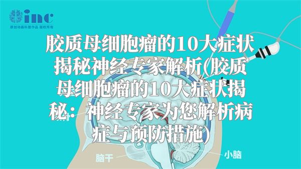 胶质母细胞瘤的10大症状揭秘神经专家解析(胶质母细胞瘤的10大症状揭秘：神经专家为您解析病症与预防措施)