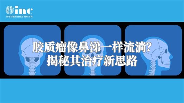 胶质瘤像鼻涕一样流淌？揭秘其治疗新思路