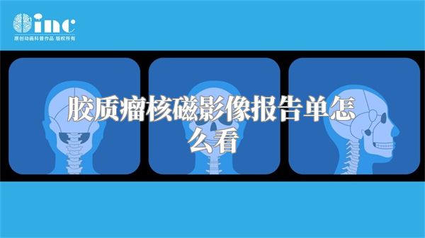 胶质瘤核磁影像报告单怎么看