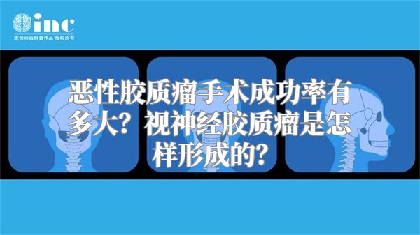 恶性胶质瘤手术成功率有多大？视神经胶质瘤是怎样形成的？