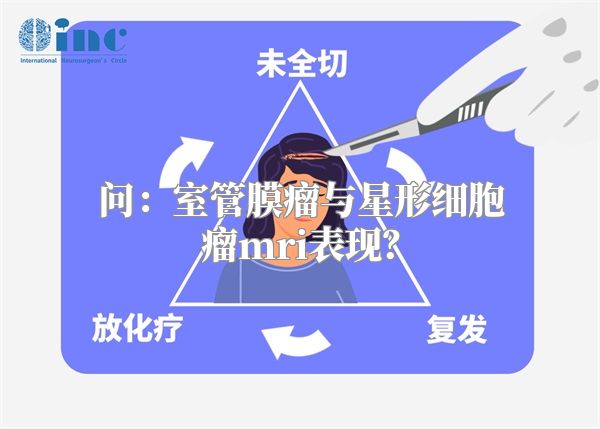 问：室管膜瘤与星形细胞瘤mri表现？