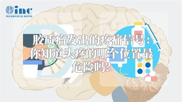 胶质瘤发出的疼痛信号：你知道头疼的哪个位置最危险吗？