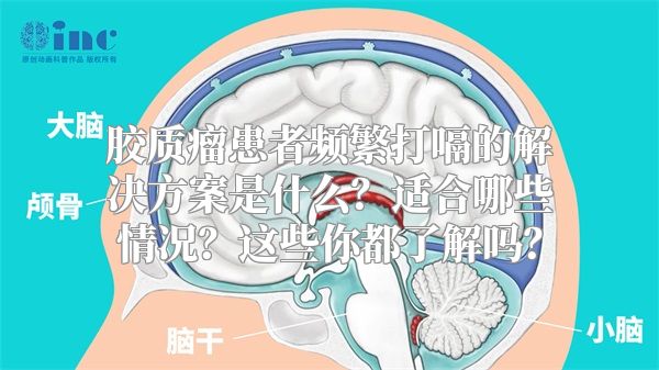 胶质瘤患者频繁打嗝的解决方案是什么？适合哪些情况？这些你都了解吗？