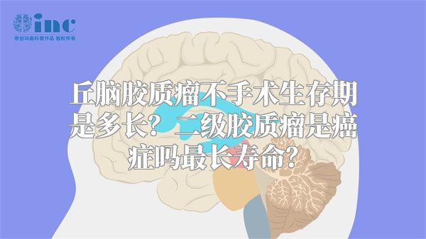 丘脑胶质瘤不手术生存期是多长？二级胶质瘤是癌症吗最长寿命？