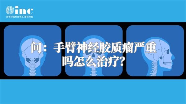 问：手臂神经胶质瘤严重吗怎么治疗？