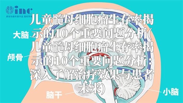 儿童髓母细胞瘤生存率揭示的10个重要问题分析(儿童髓母细胞瘤生存率揭示的10个重要问题分析：深入了解治疗效果与患者未来)