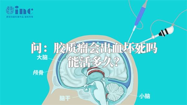 问：胶质瘤会出血坏死吗能活多久？