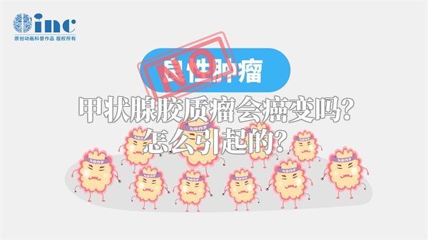 甲状腺胶质瘤会癌变吗？怎么引起的？