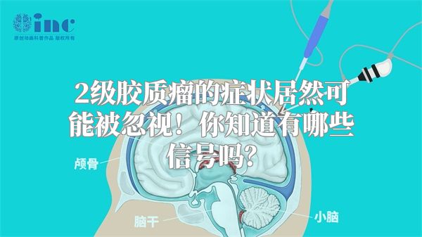 2级胶质瘤的症状居然可能被忽视！你知道有哪些信号吗？